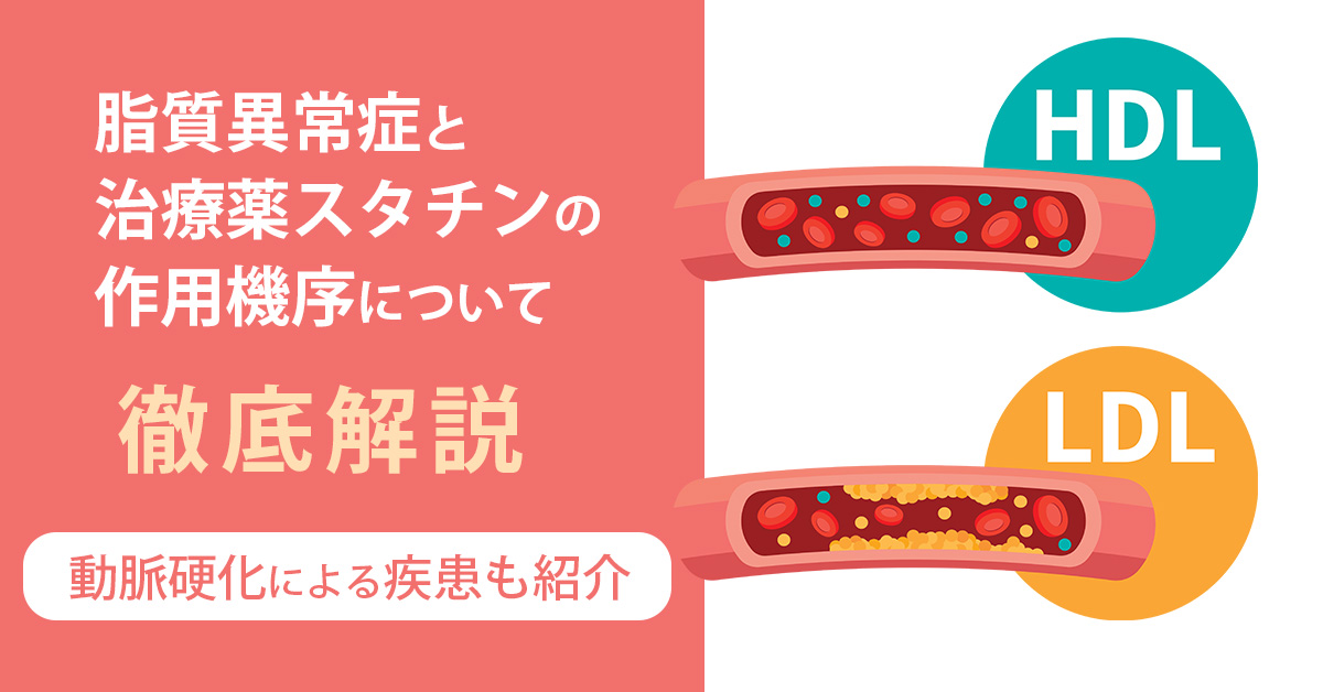 脂質異常症と治療薬スタチンの作用機序について徹底解説｜動脈硬化による疾患も紹介