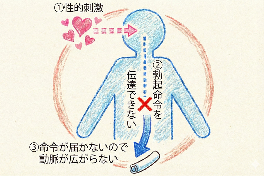 ザイデナと他のED治療薬との比較