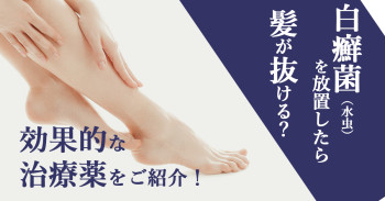 白癬菌(水虫)を放置したら髪が抜ける？効果的な治療薬をご紹介！