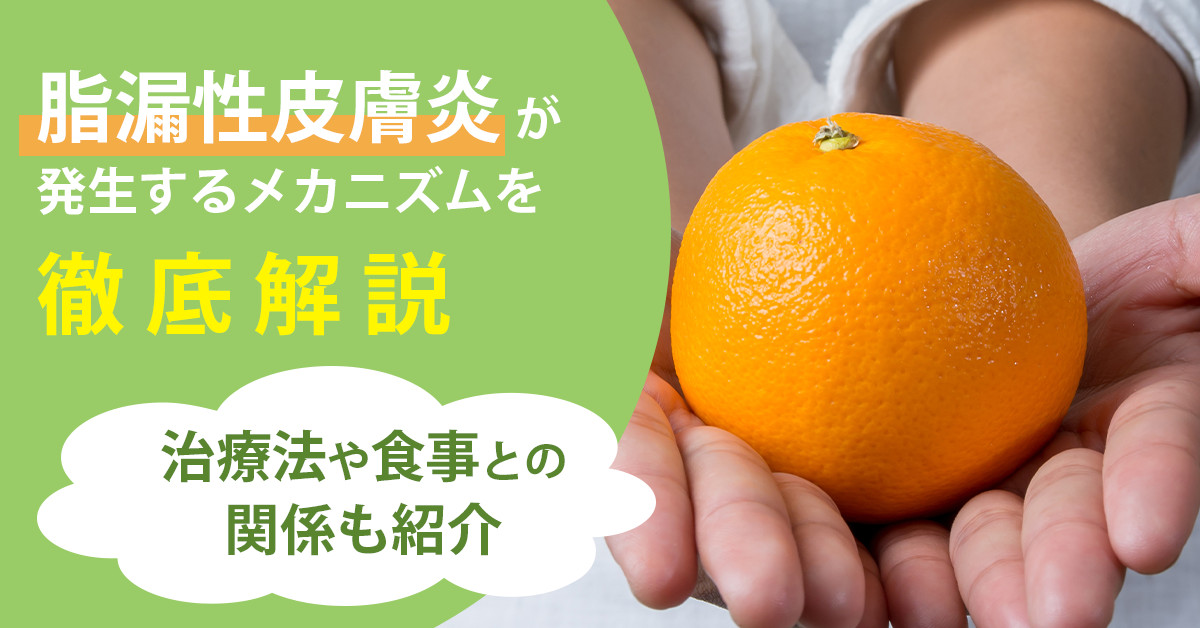 脂漏性皮膚炎が発生するメカニズムを徹底解説｜治療法や食事との関係も紹介