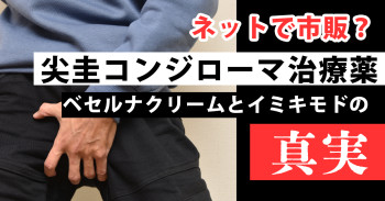 【ネットで市販？】尖圭コンジローマ治療薬：ベセルナクリームとイミキモドの真実