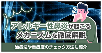 アレルギー性鼻炎が起こるメカニズムを徹底解説｜治療法や重症度のチェック方法も紹介