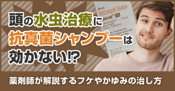 頭の水虫治療に抗真菌シャンプーは効かない!?薬剤師が解説するフケやかゆみの治し方