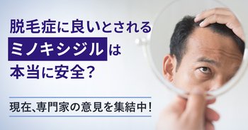 脱毛症に良いとされるミノキシジルは本当に安全？現在、専門家の意見を集結中！