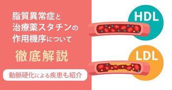脂質異常症と治療薬スタチンの作用機序について徹底解説｜動脈硬化による疾患も紹介